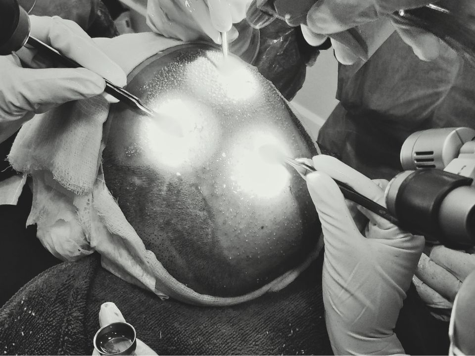 Placing the Follicular Units