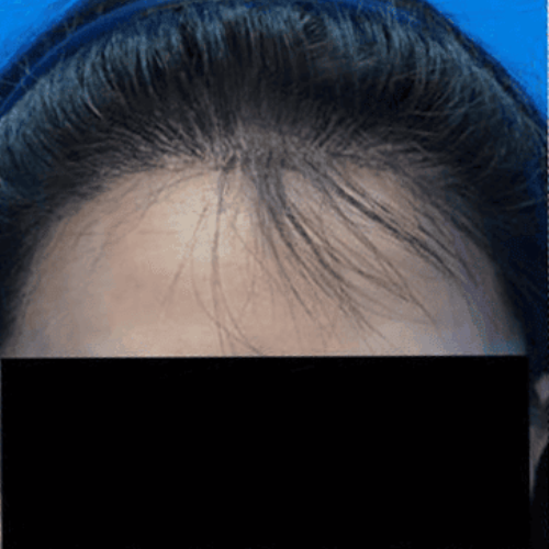 Before After (500x500)