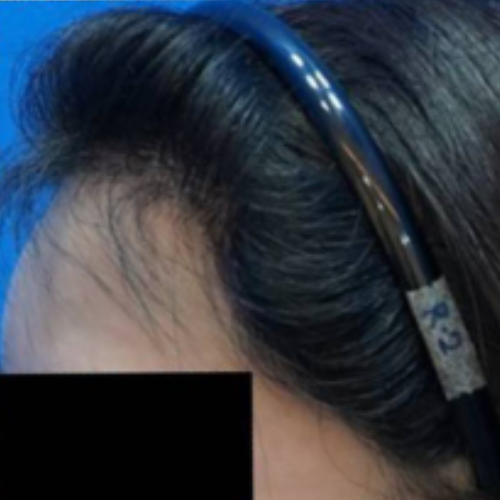 Before After (500x500) (3)