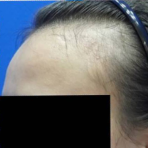 Before After (500x500) (3)