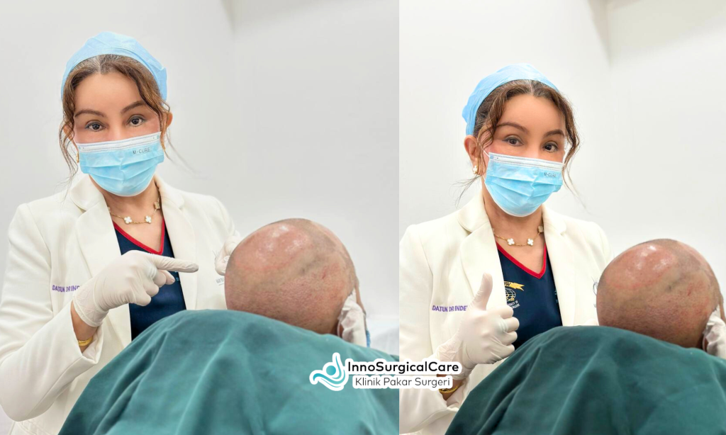Scar Revision On The Scalp